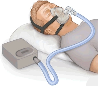 CPAP device on person