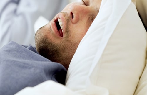 Sleep Apnea - Testing And Diagnosis